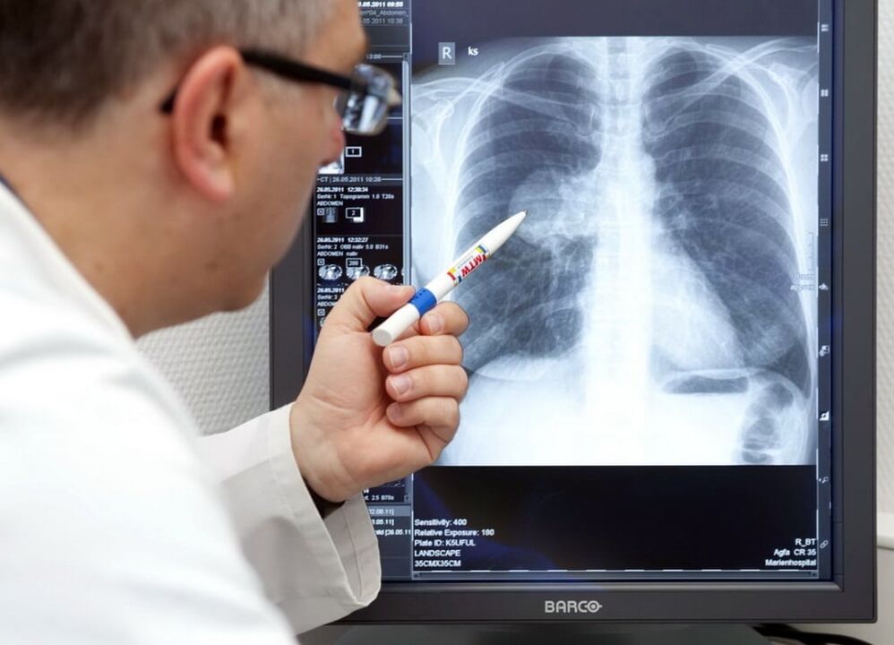 arterinės hipertenzijos diagnozė